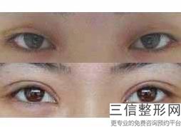 河北省好的眼部整形医院排行榜发布,河北省眼科比较好的医院