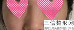 河南鼻部公立整形医院前十公认,郑州比较出名的鼻整形医生