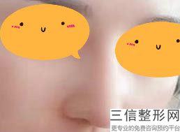 河南比较出名的隆鼻整形医院排行榜,河南整形医院排名前十
