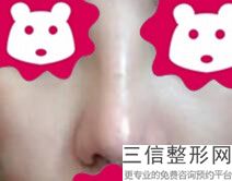 河南比较出名的隆鼻整形医院排行榜,河南整形医院排名前十
