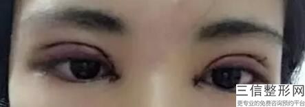 河南南阳双眼皮整形医院排名前七哪家好,南阳整形医院排名榜
