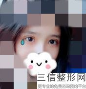 河南省双眼皮整形医院排名榜前五挨家点评,河南哪个整形医院双眼皮做的比较好