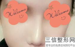 黑龙江省隆鼻整形医院排名榜top5权威评点,哈尔滨隆鼻整形整容医院