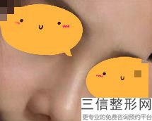 呼和浩特隆鼻医院排名前五新版公布,隆鼻公立医院哪家好