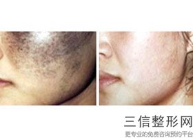 呼和浩特做热玛吉正规医院有哪些,北京哪家公立医院做热玛吉