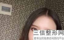 湖南眼部整形专家排行榜前五名单汇总,中国眼部整形专家排行榜