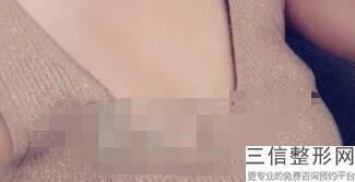 湖州隆胸整形医院排名前八权威汇总,湖州整形哪里效果好