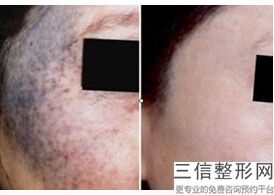洛阳热玛吉正规医院排行榜认证机构查询,热玛吉官方认证医院查询