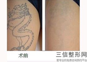 绵阳美容医院排名榜前八强新版名单揭晓,绵阳哪个医院皮肤美容科好