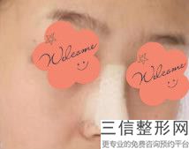 南充做鼻子整形医院排名前四强对比,南充哪家整形医院比较好