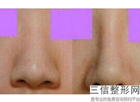 南充做鼻子整形医院排名前四强对比,南充哪家整形医院比较好