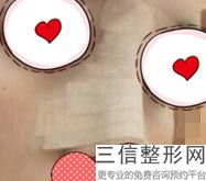 南京鼻尖整形医院排名榜前八权威盘点,南京哪家医院隆鼻手术比较好
