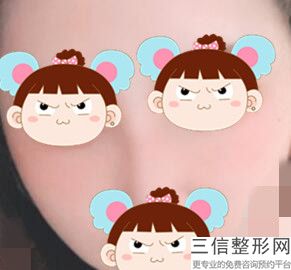 南京拉皮手术比较好的医院排行前十够硬核,上海哪家做拉皮手术良好