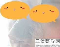 南京隆鼻整形医院排行前十都是私立版名单,南京隆鼻医生排名