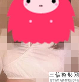 南京隆胸修复医院哪家好,南京哪家隆胸医院比较专业