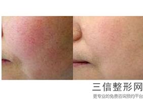 南京热玛吉授权医院排名榜top6发布,南京玛丽医院