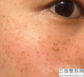 南京三甲医院有热玛吉吗,南京哪家公立医院有热玛吉
