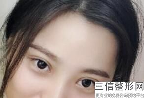 南京整形医院双眼皮排名榜top5权威公布,南京割双眼皮比较出名的整形医院