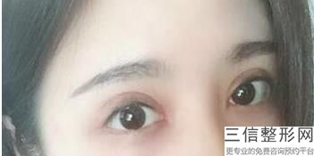 南宁做近视眼好的医院排行榜前三,南宁比较好的眼科医院