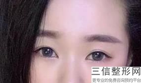 南通整形医院修复双眼皮排名榜六强盘点,南通前十名的整形医院