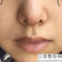 南阳公立隆胸医院排行榜,南阳隆鼻哪家医院良好