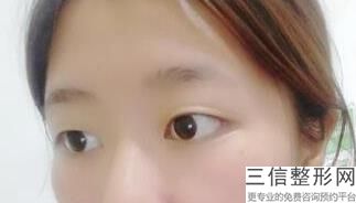 南阳眼部整形医院排行榜六强名单,南阳眼部整形哪里好