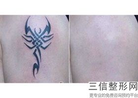 年北京热玛吉官方授权医院排名公布,热玛吉 北京三甲医院