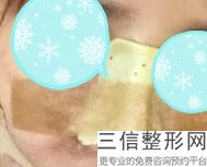 年杭州萧山隆鼻整形医院排名大公开,萧山整形科哪个医院好