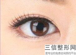 年湖州去眼袋整形医院排名前十,三甲美容整形去眼袋医院排名