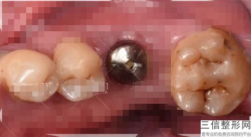 年江苏好的牙齿矫正整形口腔医院排名,全国牙齿正畸医院排名