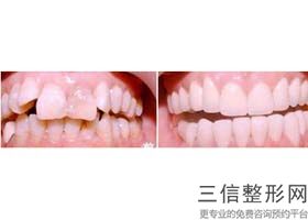 年江苏好的牙齿矫正整形口腔医院排名,全国牙齿正畸医院排名