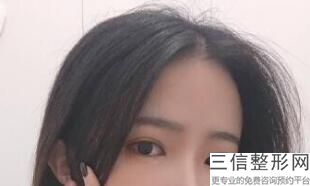 年南京比较好的双眼皮整形机构排名大公开,南京三甲医院整形双眼皮排行