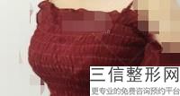 年厦门乳房整形专家排名榜前五权威点评,厦门哪家医院乳腺专家强