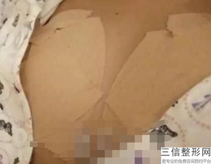 年厦门乳房整形专家排名榜前五权威点评,厦门哪家医院乳腺专家强