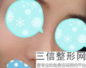 年上海鼻子整形好的医院排行公开,上海市比较出名的鼻整形