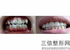 年西安种植牙好的医院排名榜top8实力横评,西安哪家医院种植牙性价比高