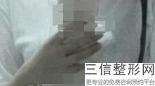 年浙江省隆胸医院排名,浙江美容医院排名前十