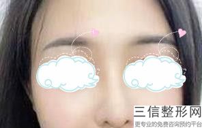 宁波硅胶隆鼻整形医院排名榜前十,宁波哪些整形医院好