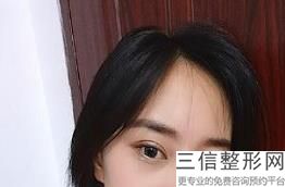 宁波开眼角整形医院排行前十已汇总,宁波十大整形医院