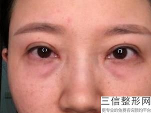 宁波开眼角整形医院排行前十已汇总,宁波十大整形医院