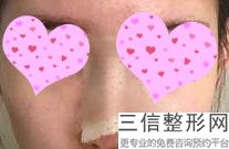 宁波隆鼻整形美容医院排名榜top10汇总,宁波良好的隆鼻医生