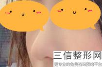 宁波隆鼻整形医院排名榜前五公布,宁波专业隆鼻整形手术