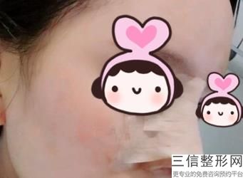 宁波隆鼻正规整形医院排名前四全新发布,宁波良好整形医院