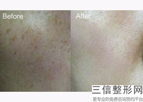 宁波热玛吉正规授权医院在线查询,热玛吉全国正规医院