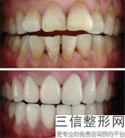 宁波牙齿矫正口腔医院排名榜top5权威盘点,宁波哪里牙齿矫正性价比很高