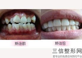 宁波牙齿矫正口腔医院排名榜top5权威盘点,宁波哪里牙齿矫正性价比很高