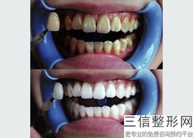 宁波牙齿矫正医院排名榜前五重磅更新,宁波牙齿矫正比较好的医院