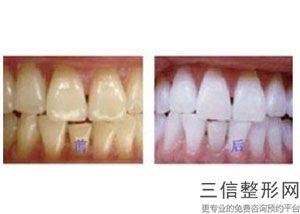 宁波牙齿整形医院排名榜top5口碑点评,宁波整牙好的三甲医院