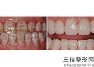 宁波牙齿整形医院排名榜top5口碑点评,宁波整牙好的三甲医院