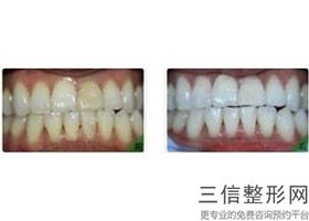 宁波牙齿整形医院排名榜top5口碑点评,宁波整牙好的三甲医院